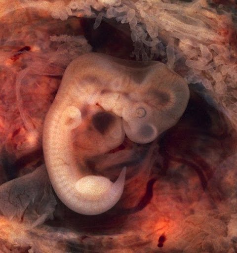 Embrião humano com cauda. (Fonte: Wikimedia Commons/Reprodução)